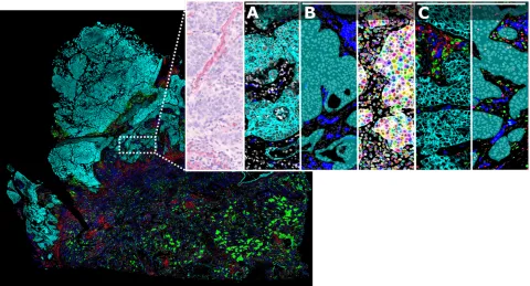 AI-driven spatial analysis