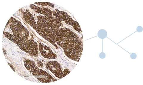 FOLR1 IHC testing